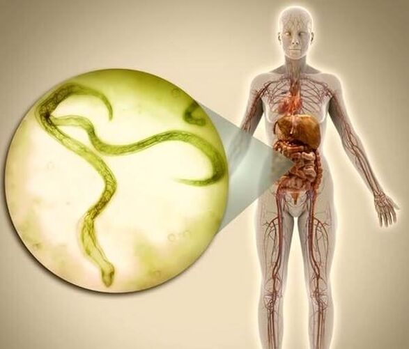 Parassiti nel corpo umano