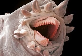 Quali vermi possono vivere nel corpo umano