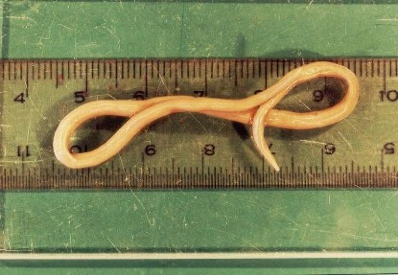 Parassita dei nematodi del corpo umano