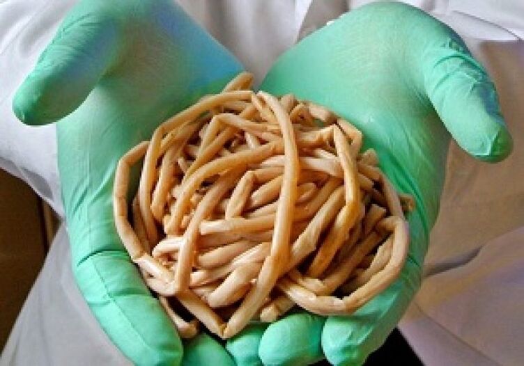 Vermi parassiti dal corpo umano
