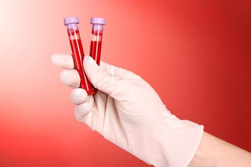 Esame del sangue per i parassiti